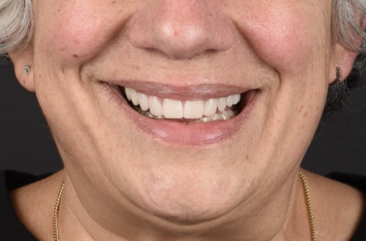 Migliora il tuo sorriso - Studio di Medicina dentale Dr. Frabboni
